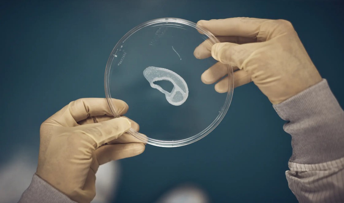 用自身細胞作為原料，首例3D列印耳朵移植成功！未來可列印更複雜器官