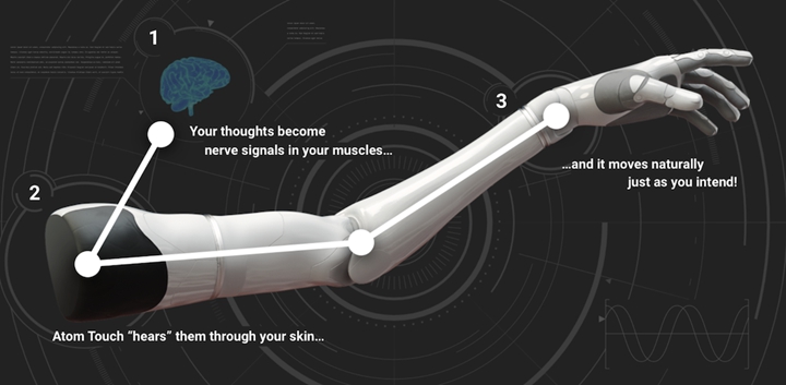 Atom Limbs 研發的肌電仿真手臂。圖片來源：Atom Limbs